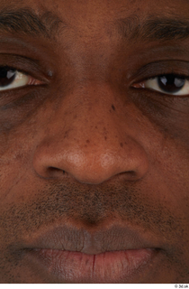 Photos of Najeem Bonner nose 0001.jpg